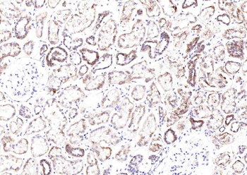 SLC44A1 Rabbit Polyclonal Antibody