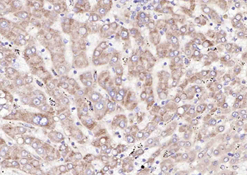 SLC44A1 Rabbit Polyclonal Antibody