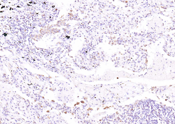SLC44A1 Rabbit Polyclonal Antibody