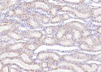SLC44A1 Rabbit Polyclonal Antibody