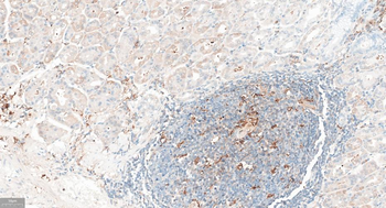 FGF21 Recombinant Rabbit Monoclonal Antibody
