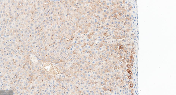 FGF21 Recombinant Rabbit Monoclonal Antibody