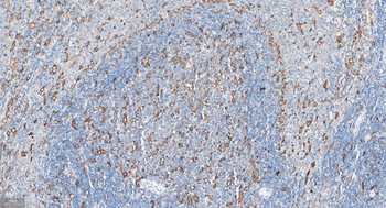 FGF21 Recombinant Rabbit Monoclonal Antibody