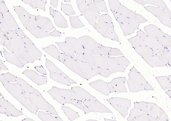Cardiac Troponin I/TNIC Mouse Monoclonal Antibody