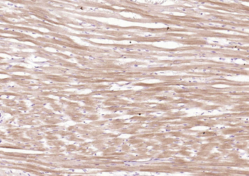 Cardiac Troponin I/TNIC Mouse Monoclonal Antibody