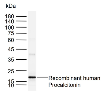 Procalcitonin (PCT) Mouse Monoclonal Antibody