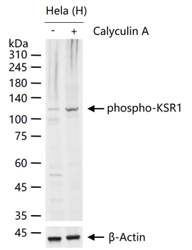 Phospho-KSR1 (Ser404) Rabbit Polyclonal Antibody