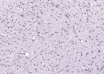 CDKN1B/p27 KIP 1 Mouse Monoclonal Antibody