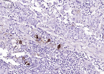 Mucin-1 Mouse Monoclonal Antibody