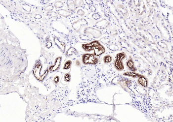 Mucin-1 Mouse Monoclonal Antibody