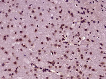 PPP3CA Rabbit Polyclonal Antibody