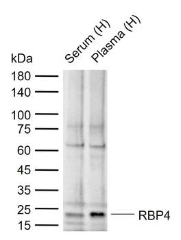 RBP4 Rabbit Polyclonal Antibody
