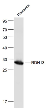 RDH13 Rabbit Polyclonal Antibody