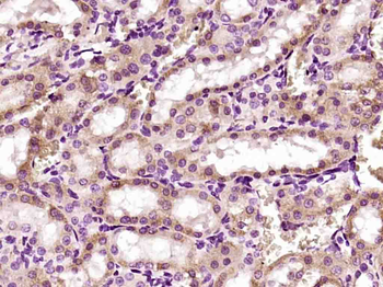 PANK4 Rabbit Polyclonal Antibody