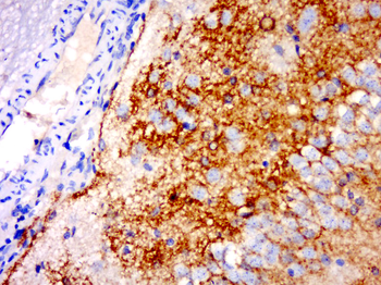 IGSF21 Rabbit Polyclonal Antibody