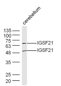IGSF21 Rabbit Polyclonal Antibody