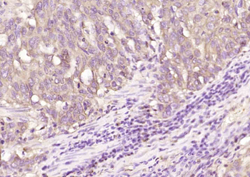 TENM3 Rabbit Polyclonal Antibody