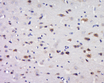 C17orf42 Rabbit Polyclonal Antibody