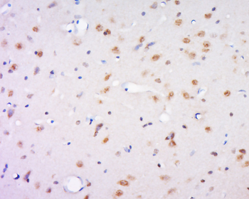 C17orf64 Rabbit Polyclonal Antibody