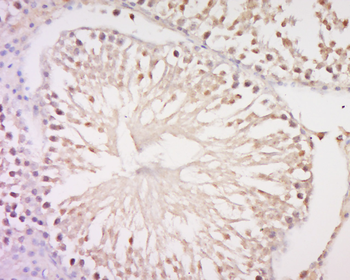 C17orf64 Rabbit Polyclonal Antibody