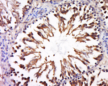 C17orf74 Rabbit Polyclonal Antibody