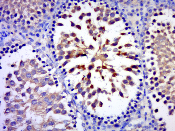 C17orf75 Rabbit Polyclonal Antibody