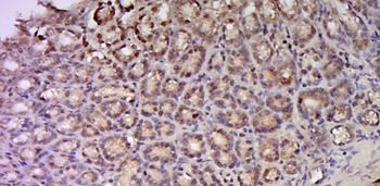 C17orf97 Rabbit Polyclonal Antibody