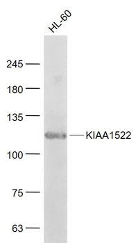 KIAA1522 Rabbit Polyclonal Antibody