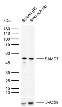 SAMD7 Rabbit Polyclonal Antibody