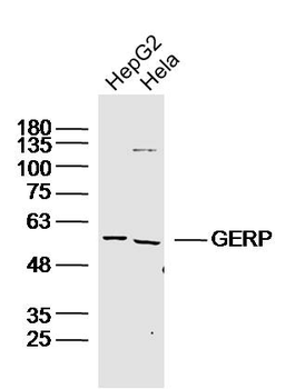 GERP Rabbit Polyclonal Antibody