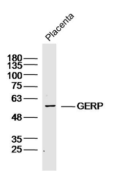 GERP Rabbit Polyclonal Antibody