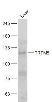 TRPM5 Rabbit Polyclonal Antibody