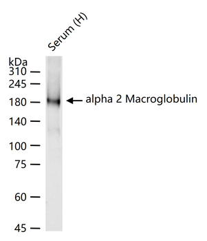 Alpha 2 Macroglobulin Rabbit Polyclonal Antibody