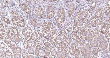 DHFR Rabbit Polyclonal Antibody