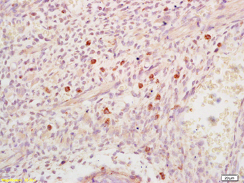 DHFR Rabbit Polyclonal Antibody