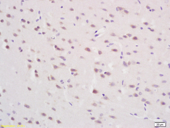 MAP4K6 Rabbit Polyclonal Antibody