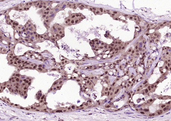 TSPAN13 Rabbit Polyclonal Antibody