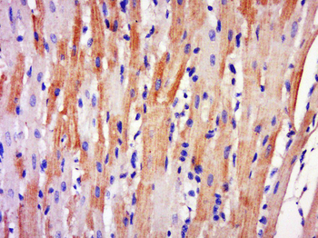 RNF158 Rabbit Polyclonal Antibody