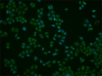 RNF31 Rabbit Polyclonal Antibody