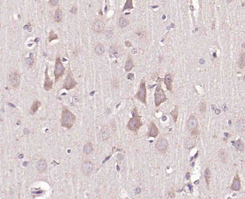 RNF31 Rabbit Polyclonal Antibody