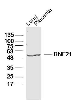 RNF21 Rabbit Polyclonal Antibody