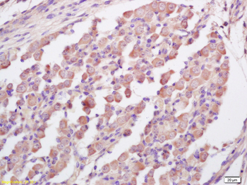 RNF123 Rabbit Polyclonal Antibody