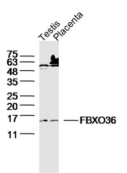 FBXO36 Rabbit Polyclonal Antibody