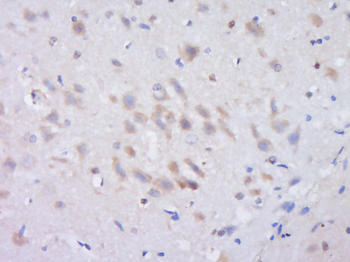 FBXO33 Rabbit Polyclonal Antibody