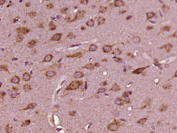 RFESD Rabbit Polyclonal Antibody