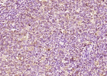 FAM76A Rabbit Polyclonal Antibody