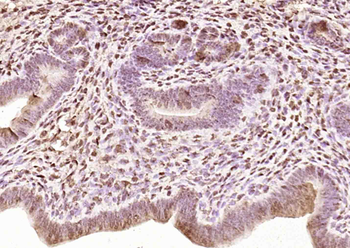 FAM76A Rabbit Polyclonal Antibody