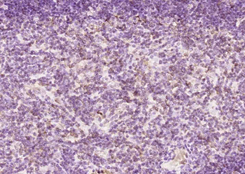 FAM76A Rabbit Polyclonal Antibody