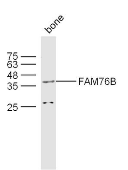 FAM76B Rabbit Polyclonal Antibody