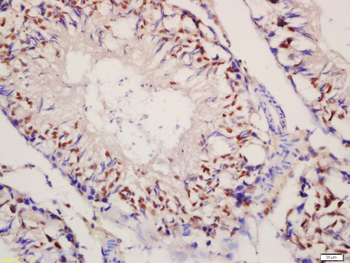 C17ORF39 Rabbit Polyclonal Antibody